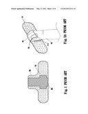 FULL COVERAGE ADHESIVE PATCH diagram and image