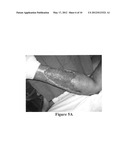 Ultrasonic dispersion of compositions in tissue diagram and image