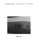 Ultrasonic dispersion of compositions in tissue diagram and image