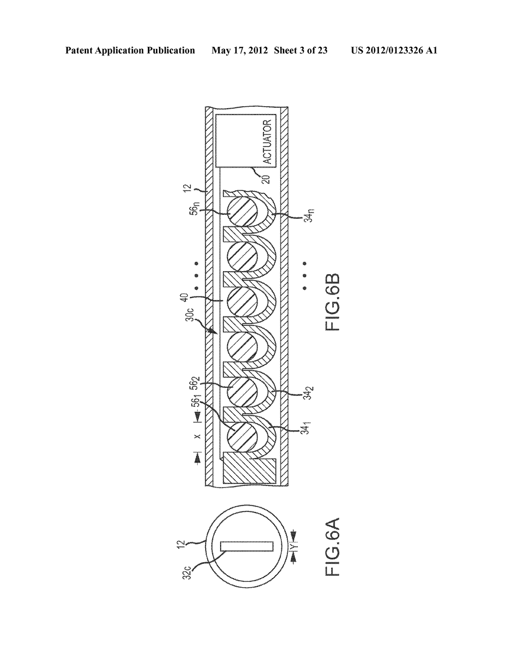 CATHETER SYSTEMS WITH DISTAL END FUNCTION, SUCH AS DISTAL DEFLECTION,     USING REMOTE ACTUATION OR LOW INPUT FORCE - diagram, schematic, and image 04