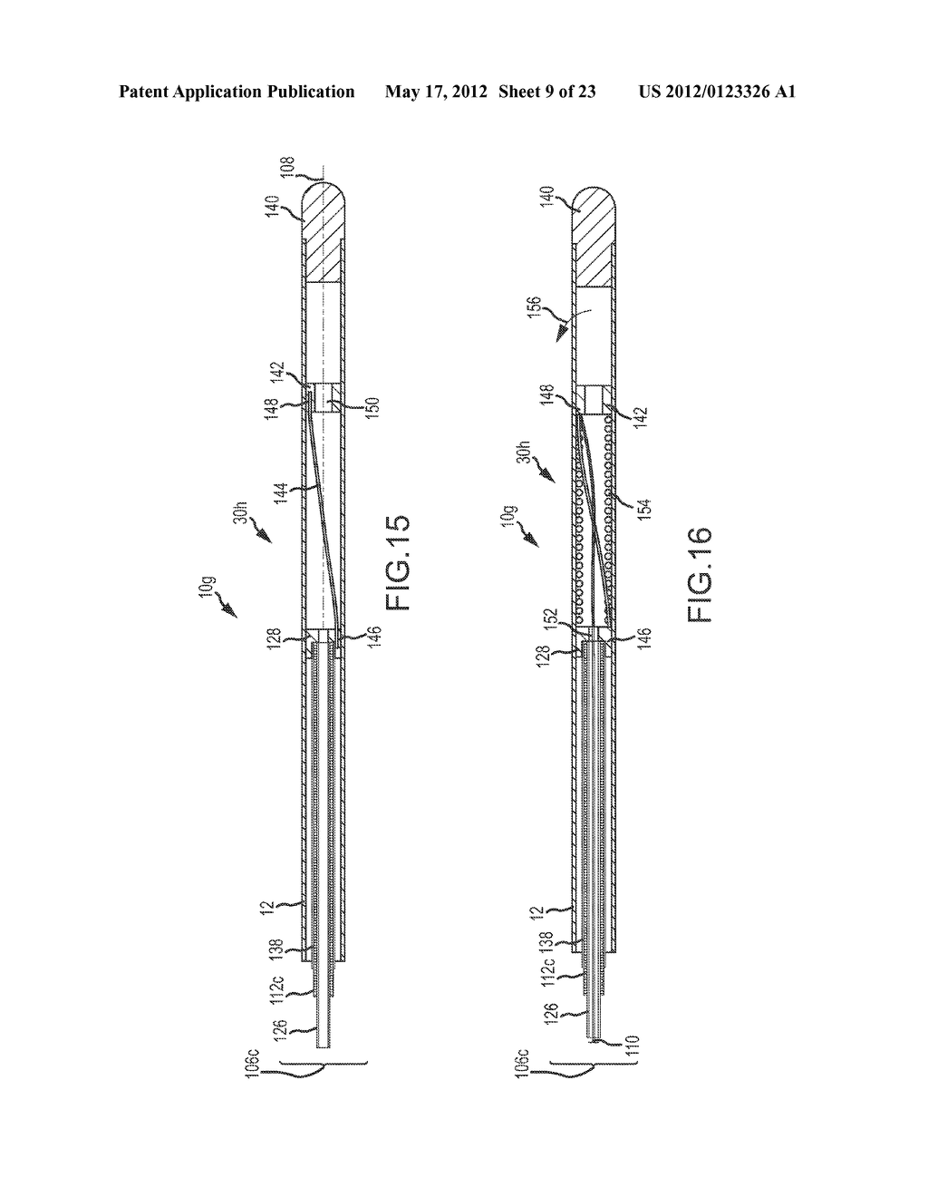 CATHETER SYSTEMS WITH DISTAL END FUNCTION, SUCH AS DISTAL DEFLECTION,     USING REMOTE ACTUATION OR LOW INPUT FORCE - diagram, schematic, and image 10