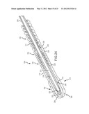 CATHETER SYSTEMS WITH DISTAL END FUNCTION, SUCH AS DISTAL DEFLECTION,     USING REMOTE ACTUATION OR LOW INPUT FORCE diagram and image