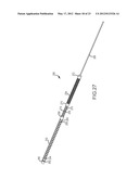 CATHETER SYSTEMS WITH DISTAL END FUNCTION, SUCH AS DISTAL DEFLECTION,     USING REMOTE ACTUATION OR LOW INPUT FORCE diagram and image