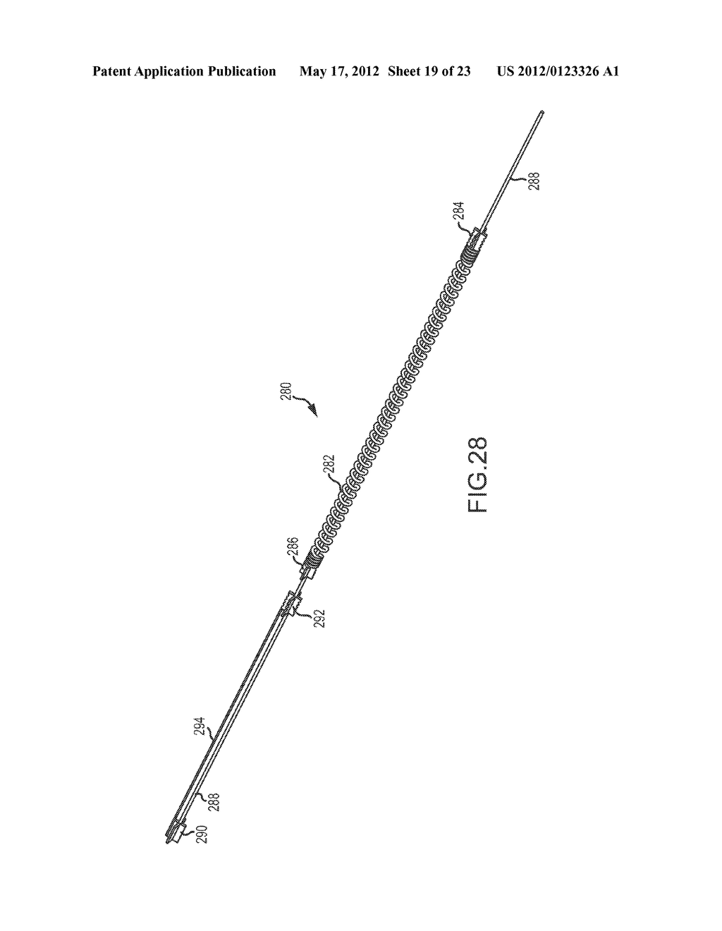 CATHETER SYSTEMS WITH DISTAL END FUNCTION, SUCH AS DISTAL DEFLECTION,     USING REMOTE ACTUATION OR LOW INPUT FORCE - diagram, schematic, and image 20