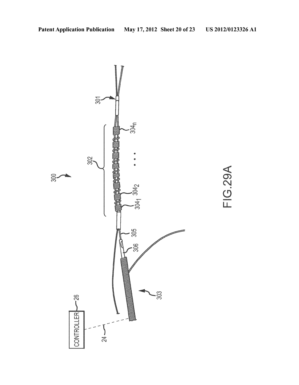 CATHETER SYSTEMS WITH DISTAL END FUNCTION, SUCH AS DISTAL DEFLECTION,     USING REMOTE ACTUATION OR LOW INPUT FORCE - diagram, schematic, and image 21