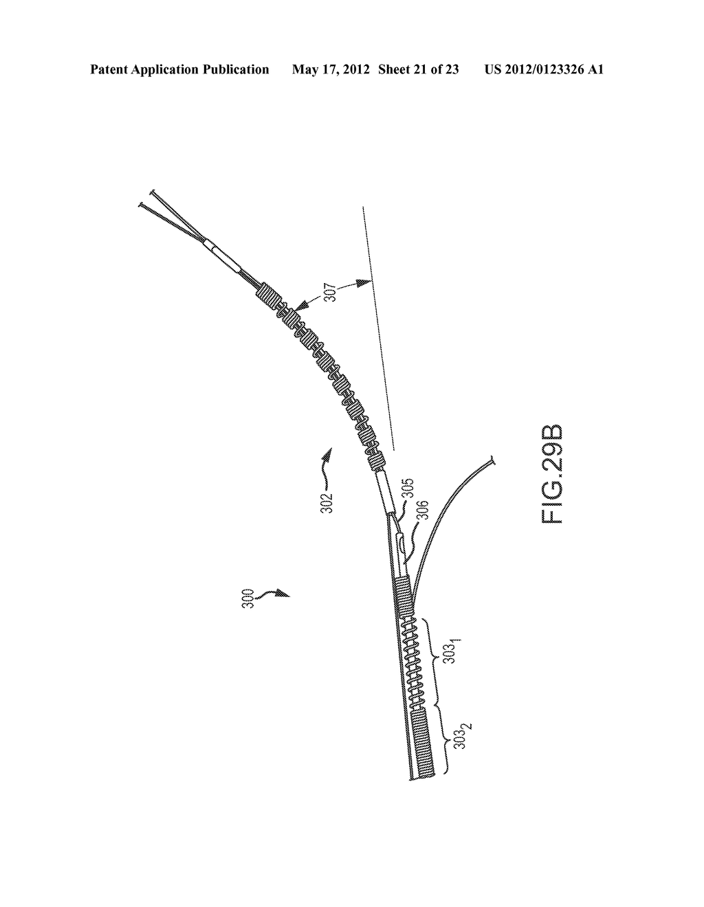 CATHETER SYSTEMS WITH DISTAL END FUNCTION, SUCH AS DISTAL DEFLECTION,     USING REMOTE ACTUATION OR LOW INPUT FORCE - diagram, schematic, and image 22