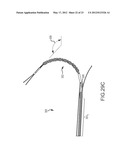 CATHETER SYSTEMS WITH DISTAL END FUNCTION, SUCH AS DISTAL DEFLECTION,     USING REMOTE ACTUATION OR LOW INPUT FORCE diagram and image