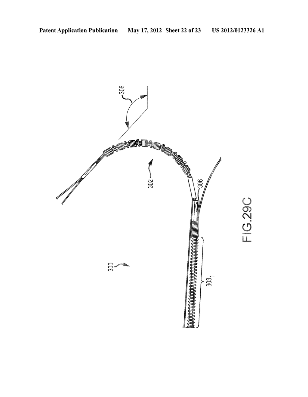 CATHETER SYSTEMS WITH DISTAL END FUNCTION, SUCH AS DISTAL DEFLECTION,     USING REMOTE ACTUATION OR LOW INPUT FORCE - diagram, schematic, and image 23