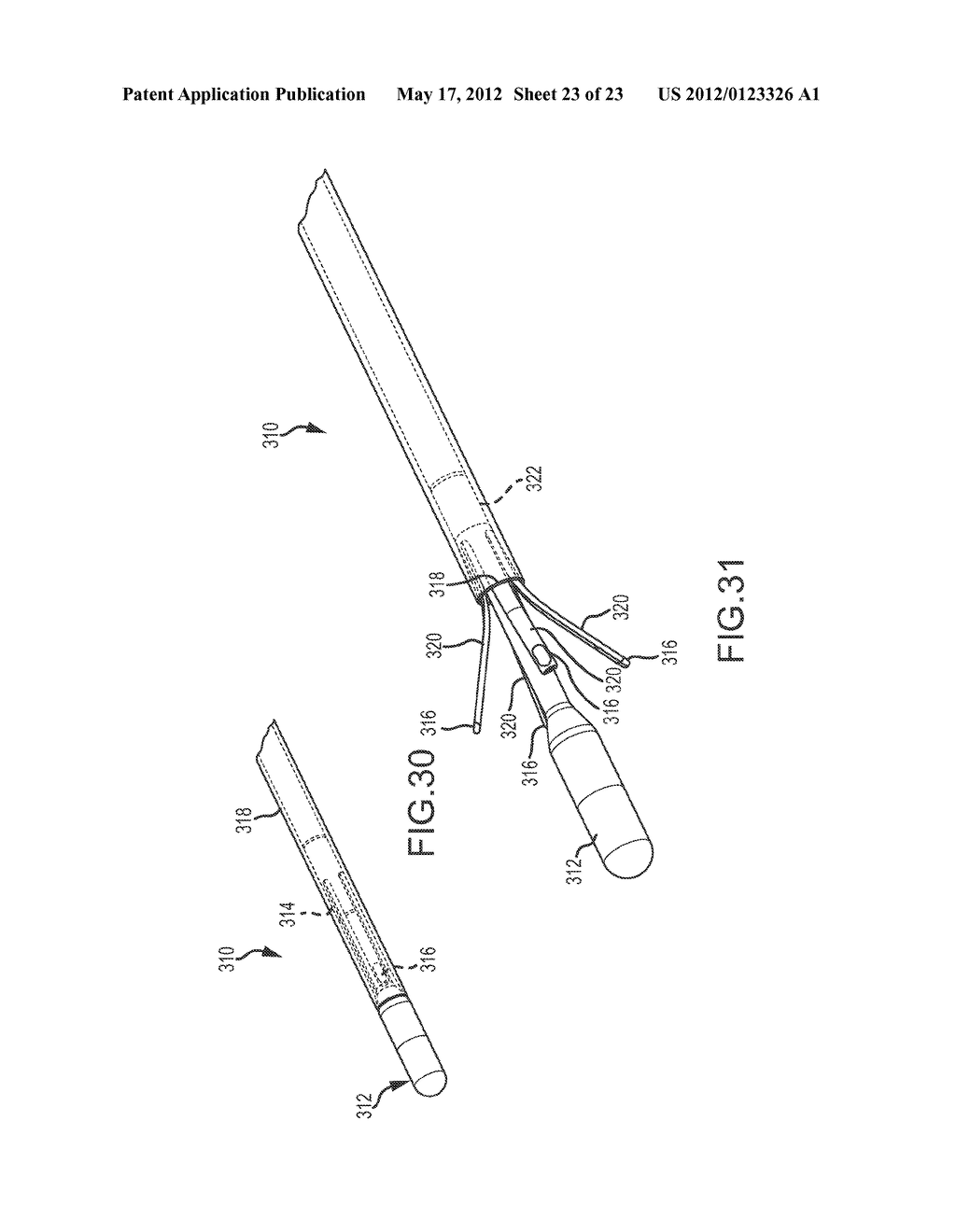 CATHETER SYSTEMS WITH DISTAL END FUNCTION, SUCH AS DISTAL DEFLECTION,     USING REMOTE ACTUATION OR LOW INPUT FORCE - diagram, schematic, and image 24