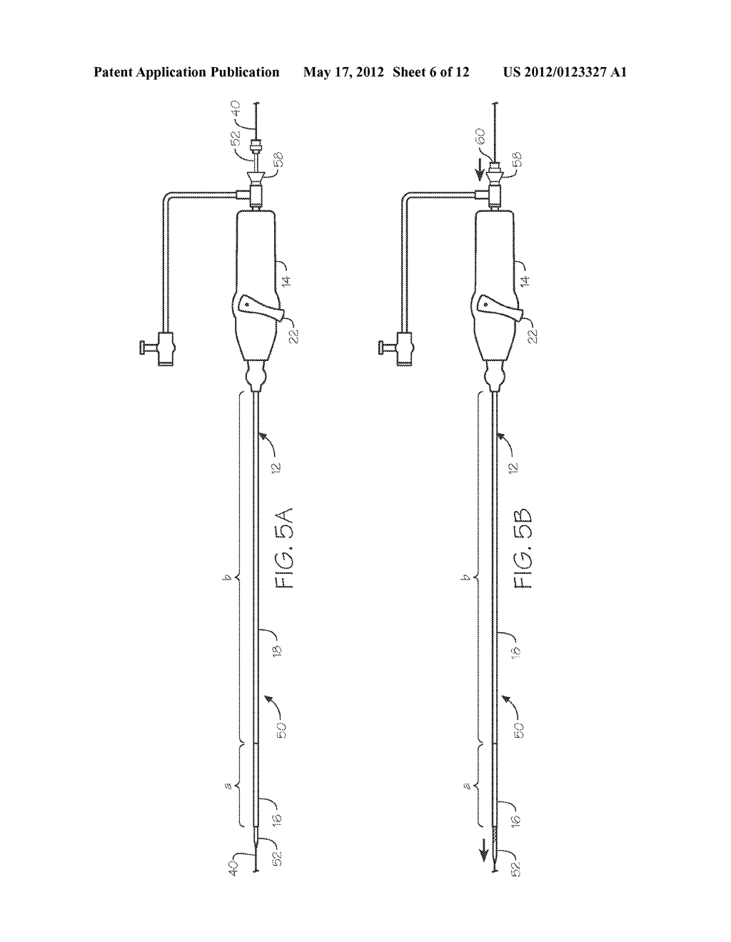 STEERABLE ENDOLUMINAL DEVICES AND METHODS - diagram, schematic, and image 07