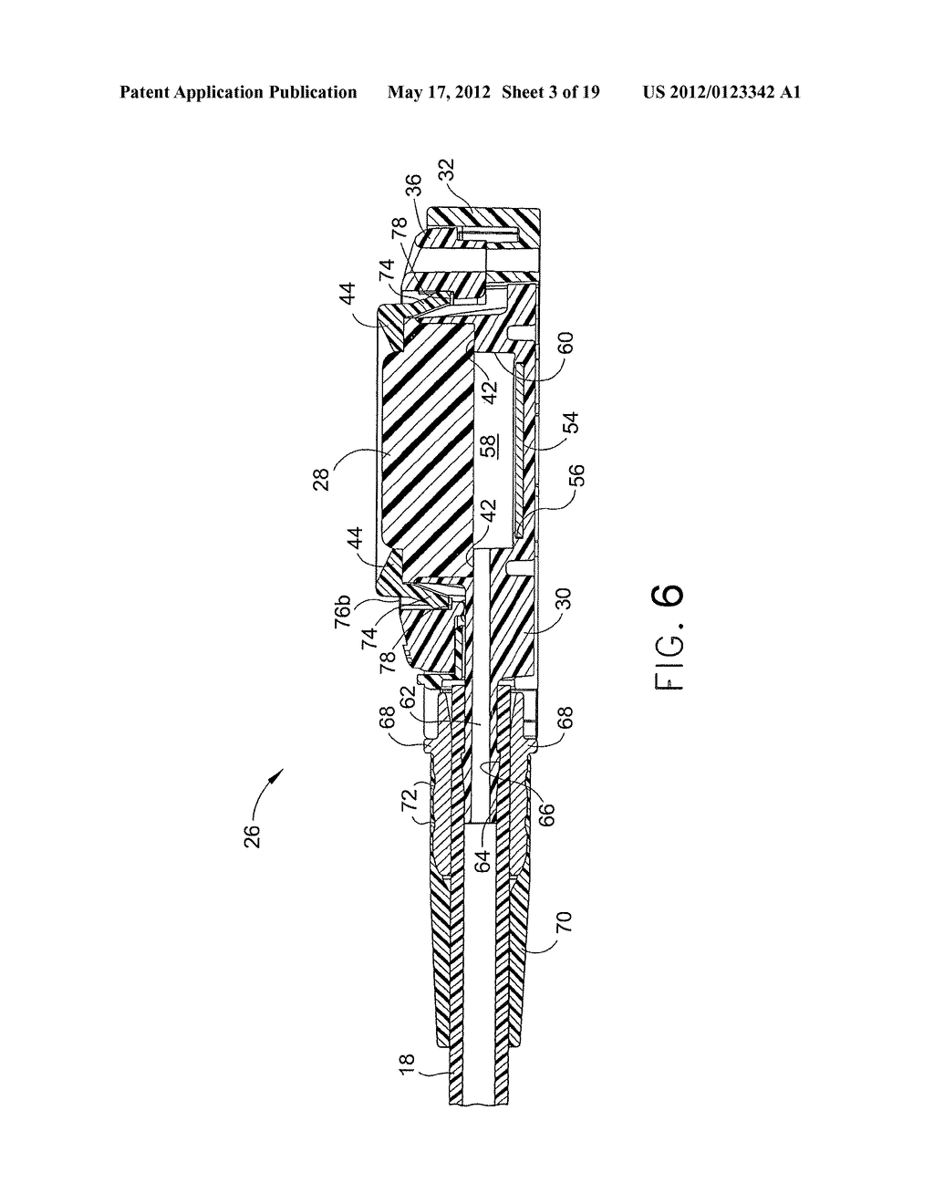 IMPLANTABLE INJECTION PORT WITH TISSUE IN-GROWTH PROMOTER - diagram, schematic, and image 04