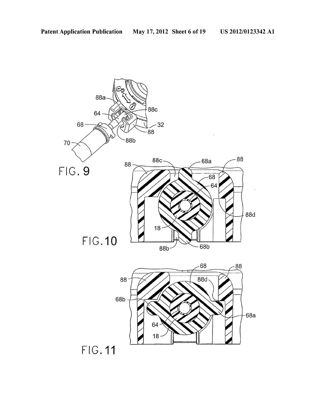 IMPLANTABLE INJECTION PORT WITH TISSUE IN-GROWTH PROMOTER - diagram, schematic, and image 07