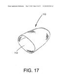 IMPLANTABLE INJECTION PORT WITH TISSUE IN-GROWTH PROMOTER diagram and image