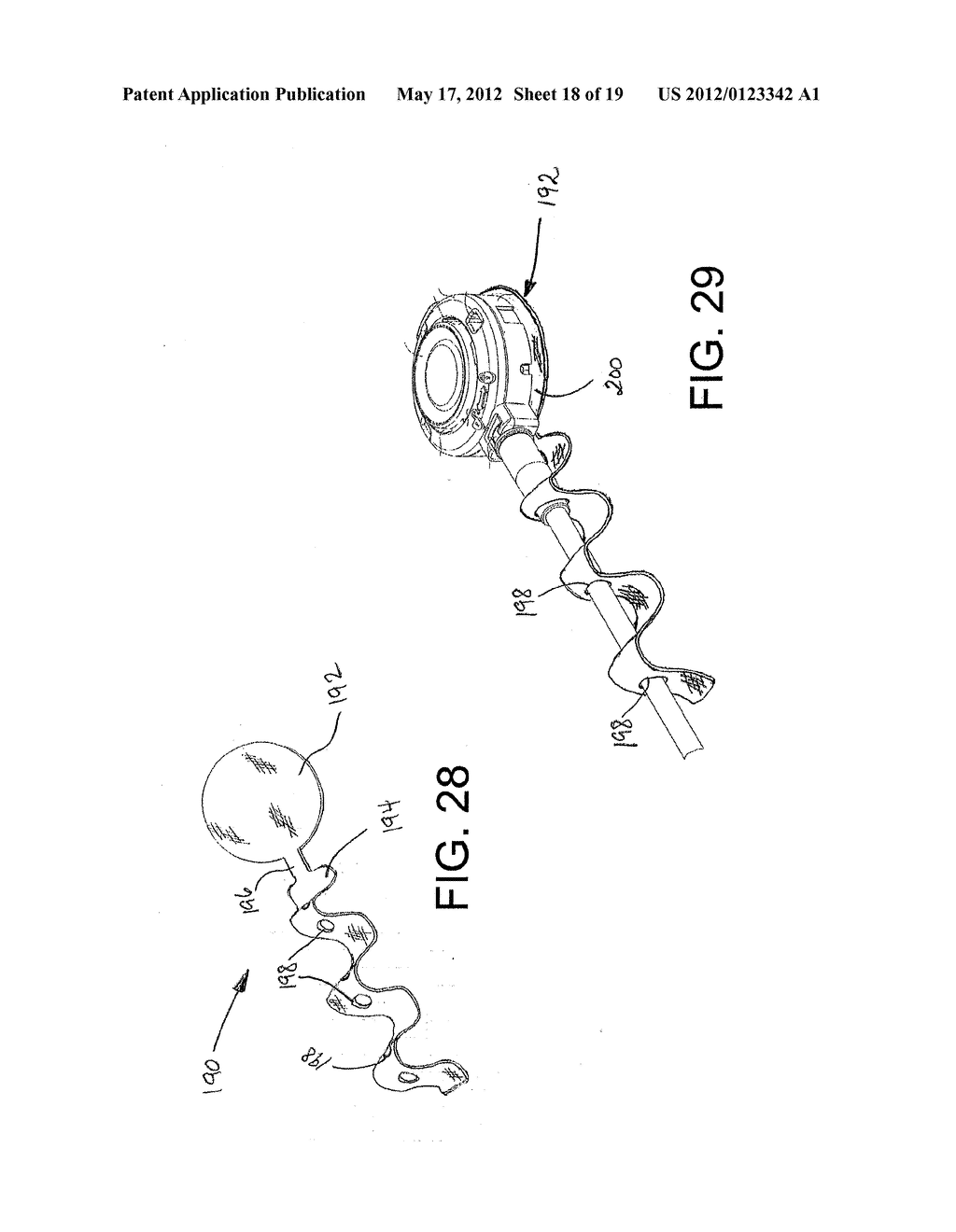 IMPLANTABLE INJECTION PORT WITH TISSUE IN-GROWTH PROMOTER - diagram, schematic, and image 19