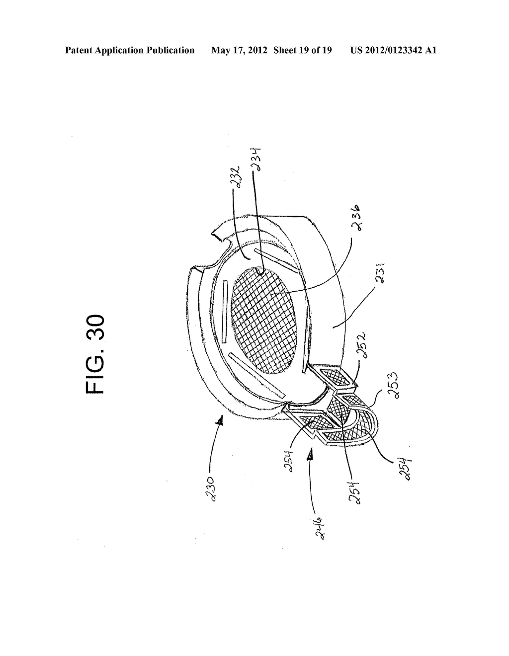 IMPLANTABLE INJECTION PORT WITH TISSUE IN-GROWTH PROMOTER - diagram, schematic, and image 20