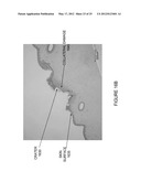 METHODS AND DEVICES FOR TISSUE ABLATION diagram and image