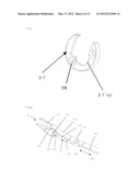 MEDICAL TREATMENT DEVICE diagram and image