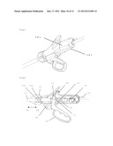 MEDICAL TREATMENT DEVICE diagram and image