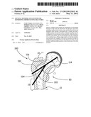 Devices, Methods and Systems for Remedying or Preventing Fractures diagram and image