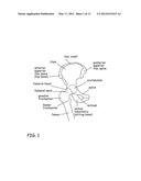 Devices, Methods and Systems for Remedying or Preventing Fractures diagram and image