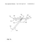 Devices, Methods and Systems for Remedying or Preventing Fractures diagram and image