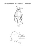 POSITIONING GUIDE AND BONE CUTTING GUIDE SYSTEM diagram and image