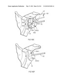 POSITIONING GUIDE AND BONE CUTTING GUIDE SYSTEM diagram and image