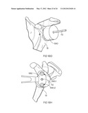 POSITIONING GUIDE AND BONE CUTTING GUIDE SYSTEM diagram and image