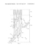 SUTURELESS VASCULAR ANASTOMOSIS CONNECTION diagram and image