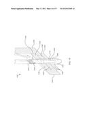 SUTURELESS VASCULAR ANASTOMOSIS CONNECTION diagram and image