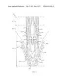 SUTURELESS VASCULAR ANASTOMOSIS CONNECTION diagram and image