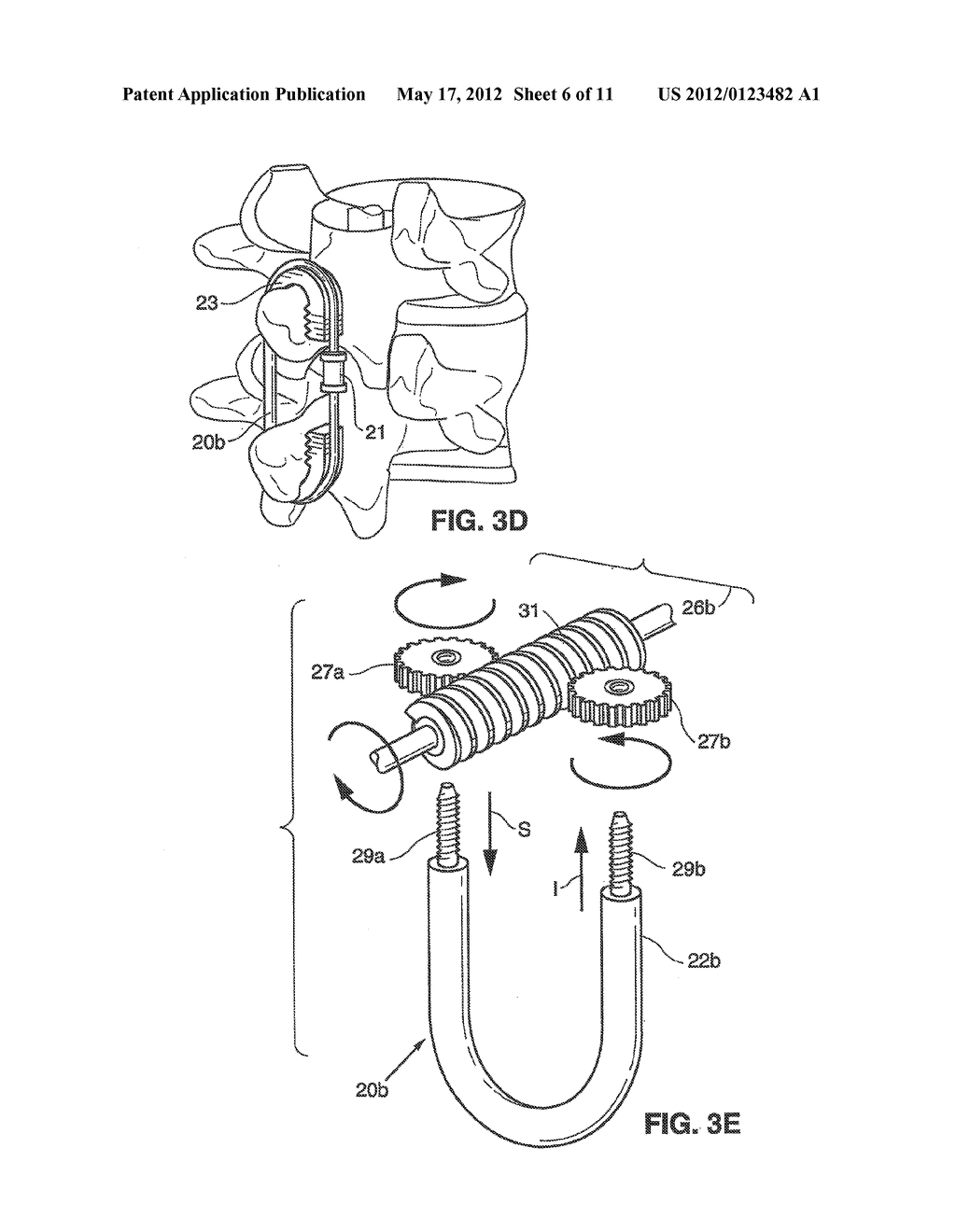 SPINAL IMPLANT AND METHOD FOR RESTRICTING SPINAL FLEXION - diagram, schematic, and image 07