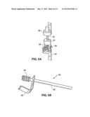 SPINAL IMPLANT AND METHOD FOR RESTRICTING SPINAL FLEXION diagram and image