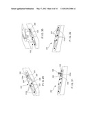 Ulna Osteotomy System diagram and image