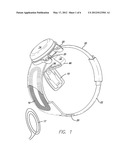 Visual Prosthesis with an Improved Electrode Array Adapted for Foveal     Stimulation diagram and image