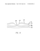 Visual Prosthesis with an Improved Electrode Array Adapted for Foveal     Stimulation diagram and image