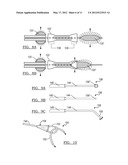 SYSTEM AND METHOD FOR REMOVING AN IMPLANTED OBJECT IN A PASSAGEWAY IN A     PATIENT diagram and image