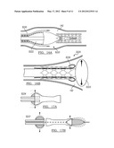 SYSTEM AND METHOD FOR REMOVING AN IMPLANTED OBJECT IN A PASSAGEWAY IN A     PATIENT diagram and image