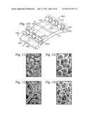 JOINT IMPLANT FIXATION SYSTEM diagram and image