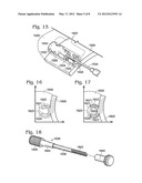 JOINT IMPLANT FIXATION SYSTEM diagram and image