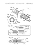 JOINT IMPLANT FIXATION SYSTEM diagram and image