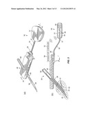 DETERMINATION AND APPLICATION OF GLUCOSE SENSOR RELIABILITY INDICATOR     AND/OR METRIC diagram and image