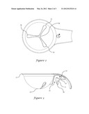 EGG SEPARATOR diagram and image