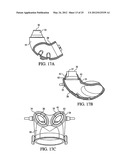 PATIENT INTERFACE ASSEMBLY AND SYSTEM USING SAME diagram and image