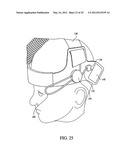 PATIENT INTERFACE ASSEMBLY AND SYSTEM USING SAME diagram and image