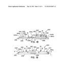 HIGH YIELD LADLE BOTTOMS diagram and image