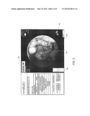 DOSE LEVEL INDICATION diagram and image