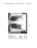 DOSE LEVEL INDICATION diagram and image