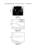 METHOD AND SYSTEM FOR PROCESSING ULTRASOUND DATA diagram and image