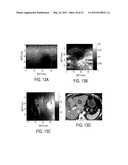 METHOD AND SYSTEM FOR PROCESSING ULTRASOUND DATA diagram and image